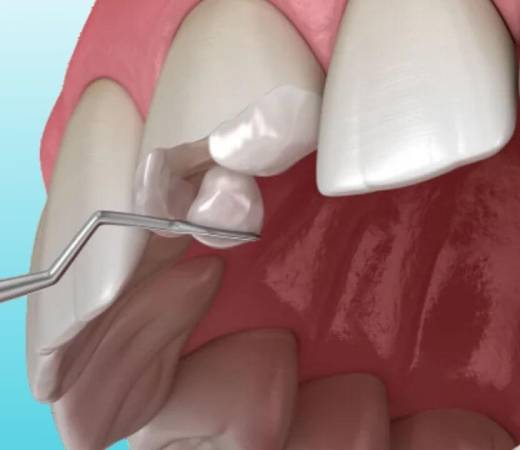 Cosmetic Dentists in Ahmedabad