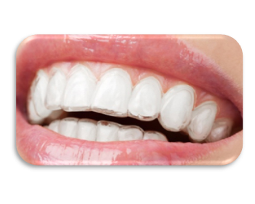 Invisible Braces
